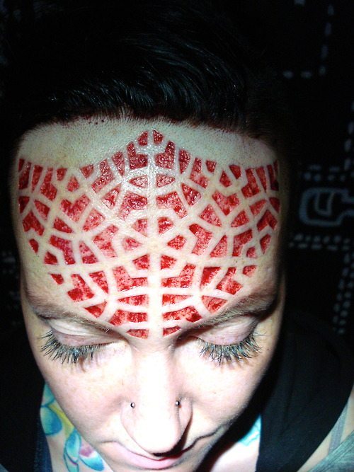 scarification